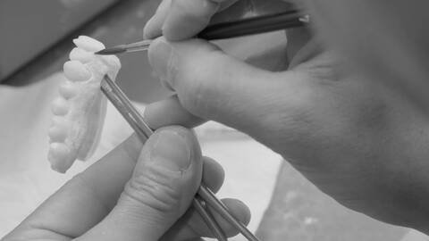 05 | Verblendtechnik